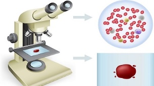 Rauchen und Blut spenden für Tests